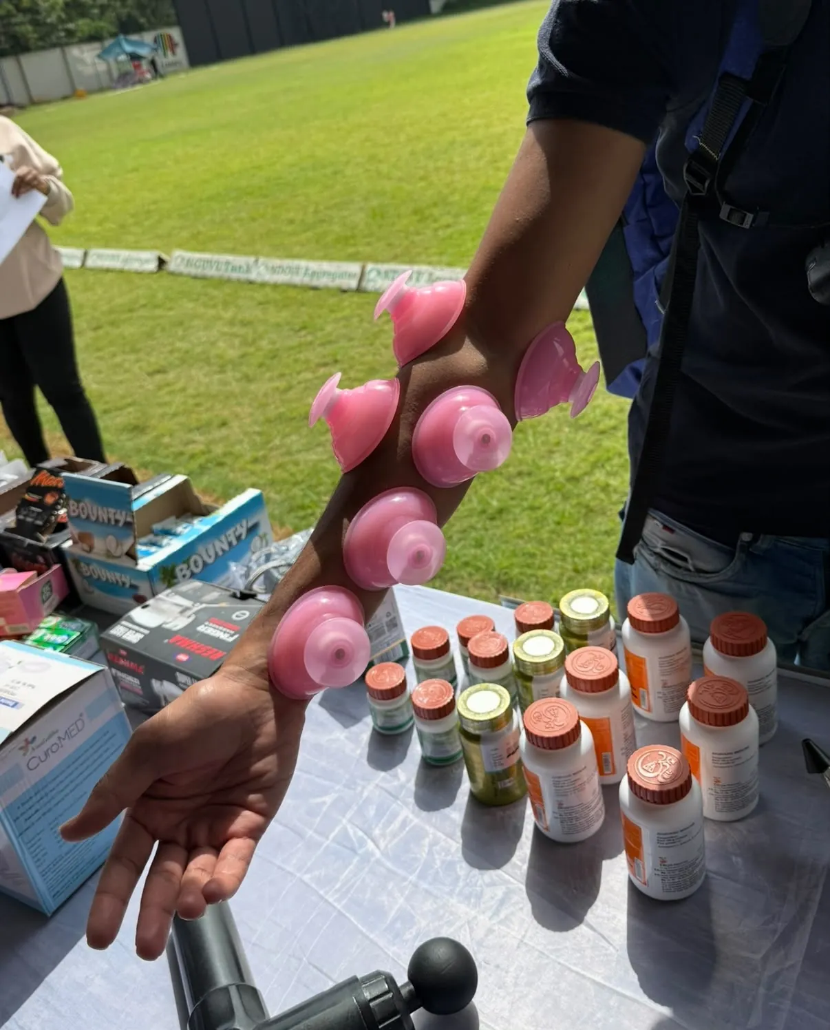 Cupping therapy demonstration during a wellness outreach